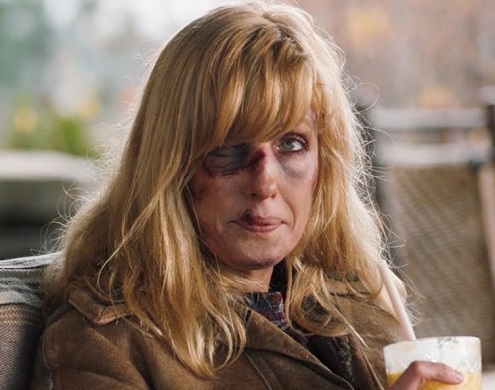 Beth Dutton with a bruised and cut face on Yellowstone